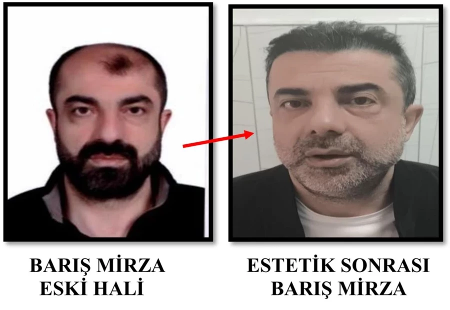 Estetikle yüzünü değiştirdi, geçmişinden kaçamadı! 7 yıllık firari yakalandı - Sayfa 5