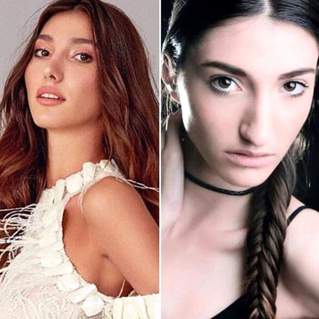 Miss Turkey 2018 güzeli "estetik harikası" çıktı! Tacı geri mi alınacak? - Sayfa 5